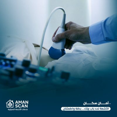 أشعة دوبلر ودوبلكس بالمنزل