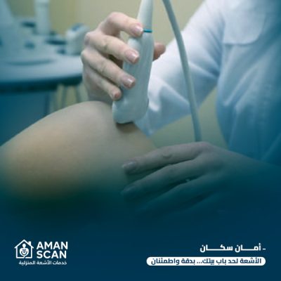 أشعة سونار بالمنزل