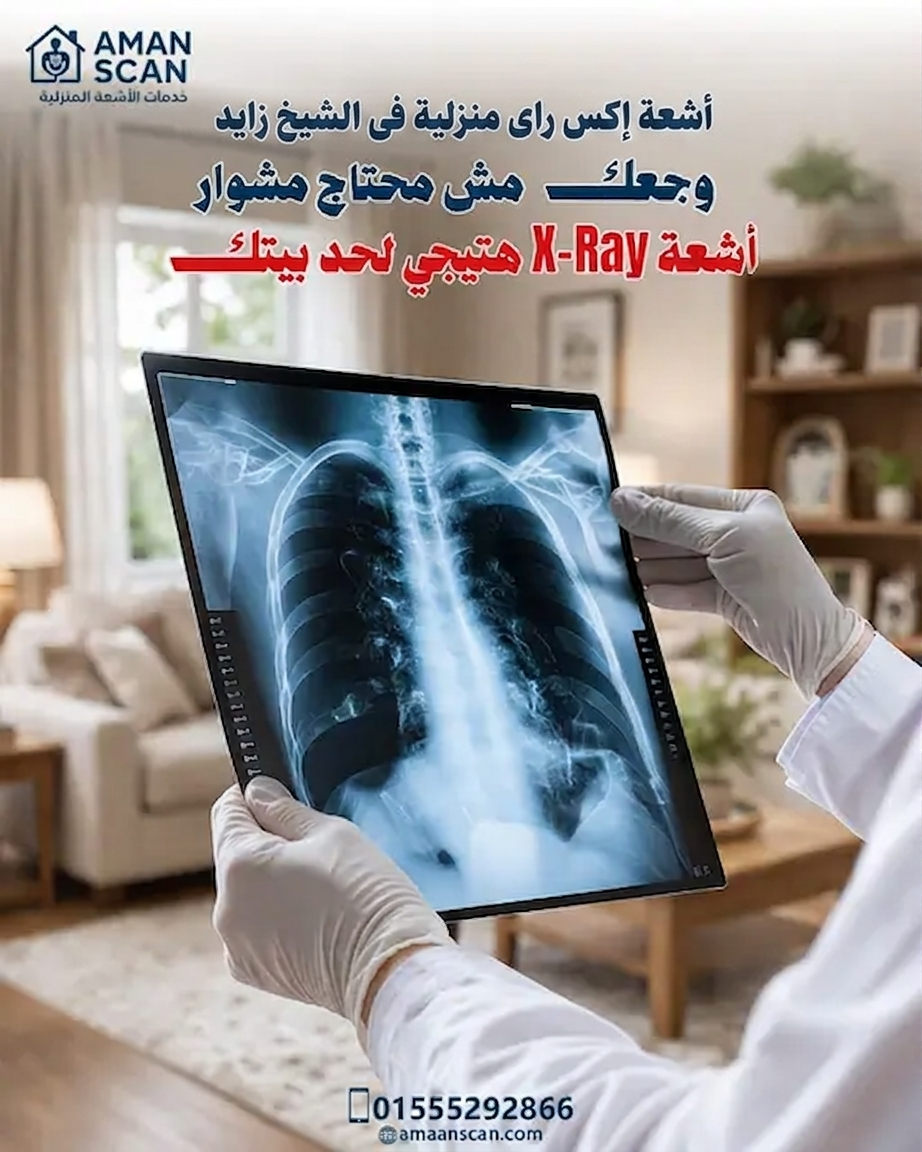 اشعة-اكس-راى-منزلية-في-الشيخ-زايد