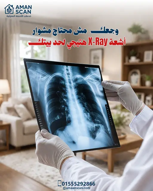 اشعة-اكس-راى-منزلية-في-القاهرة